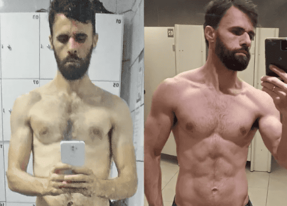 Antes e depois — Rafael